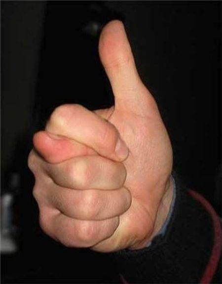 Thumbs up